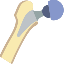 Hip Replacement